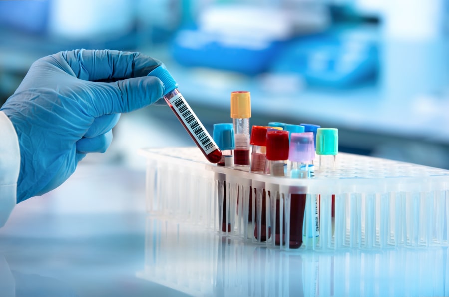 Elevated Potassium Levels In Patients With Heart Failure Elevated Potassium Levels In Patients With Heart Failure