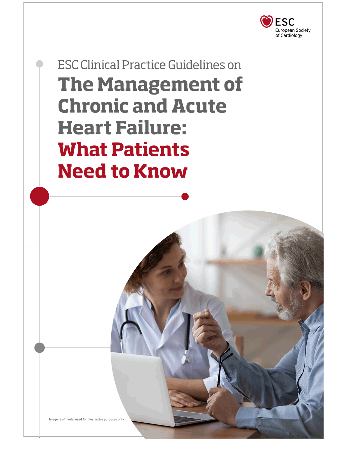 ESC Clinical Practice Guidelines on The Management of Chronic and Acute Heart Failure